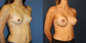 Before and After Image