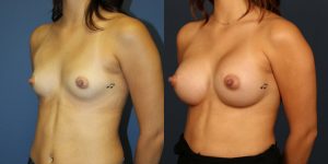 Before and After Image