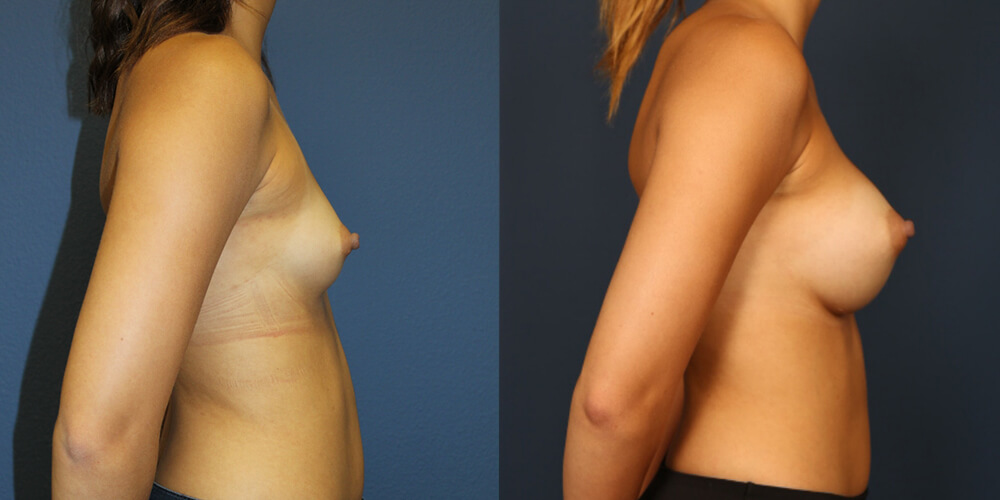 Before and After Image