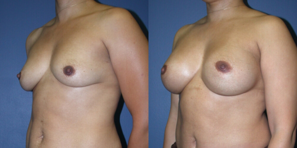 Before and After Image