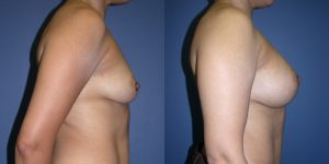 Before and After Image