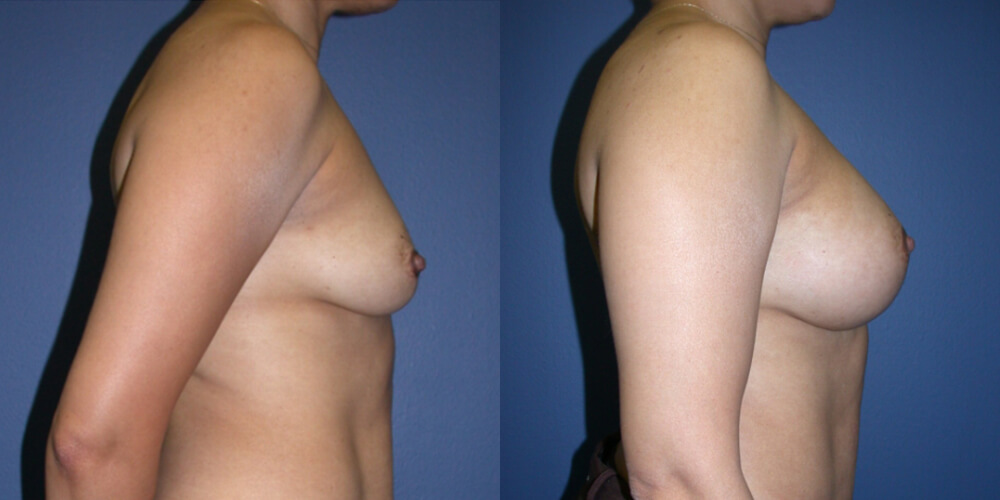 Before and After Image