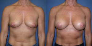 Before and After Image