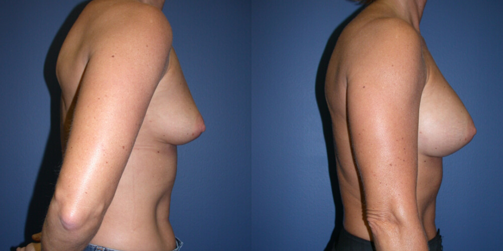 Before and After Image