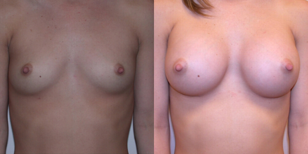 Before and After Image