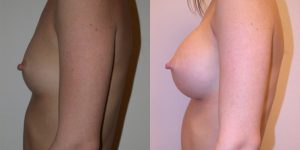 Before and After Image