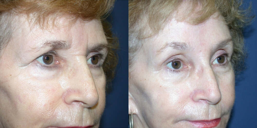 Before and After Image