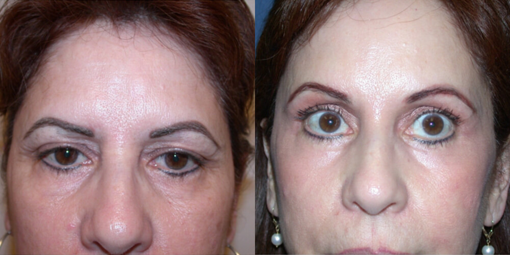 Before and After Image