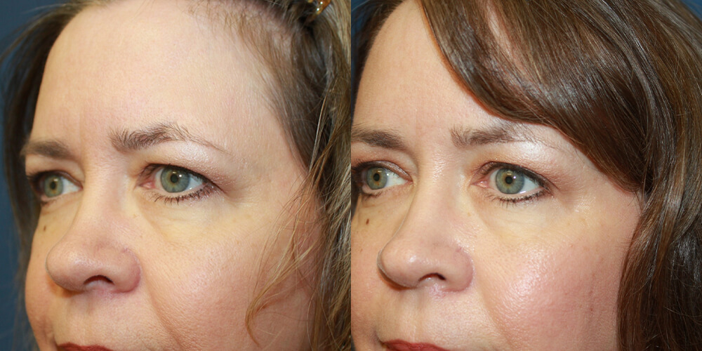 Before and After Image