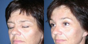 Before and After Image