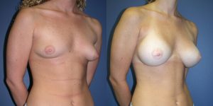 Before and After Image