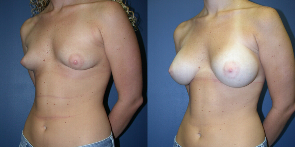 Before and After Image