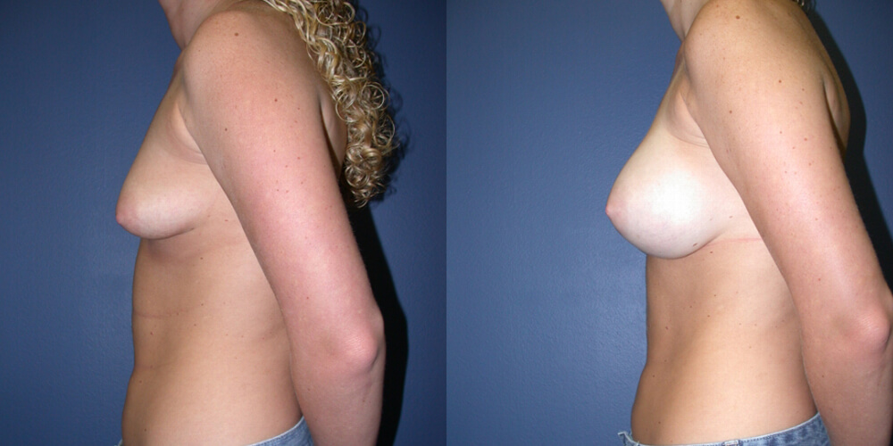 Before and After Image