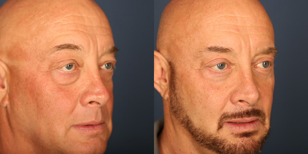 Before and After Image