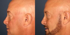 Before and After Image