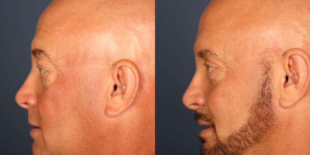 Before and After Image