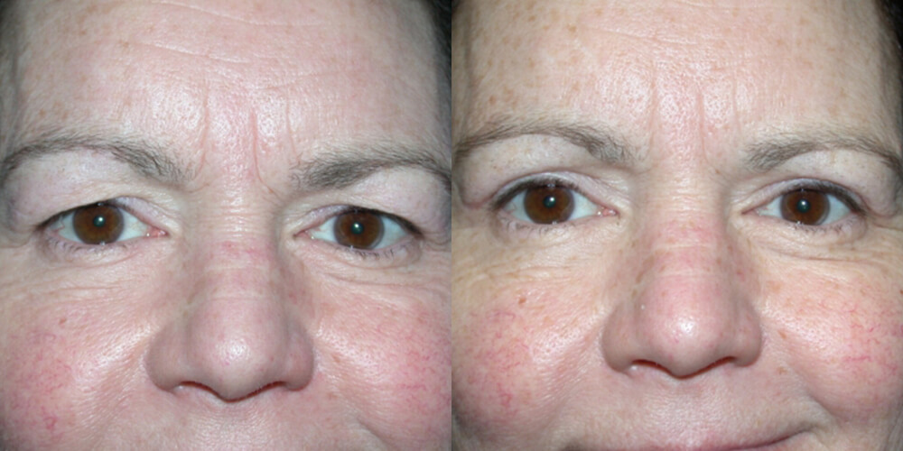 Before and After Image