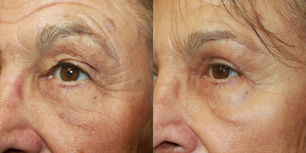 Before and After Image