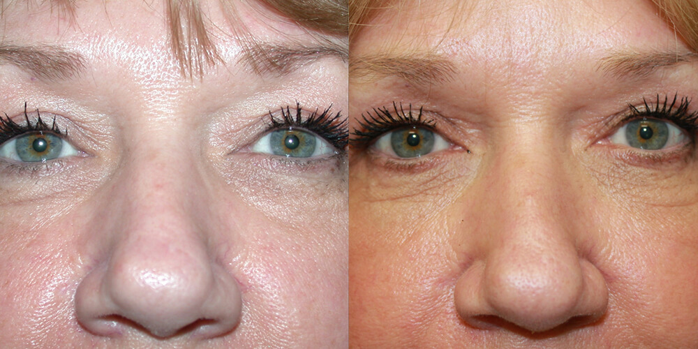 Before and After Image