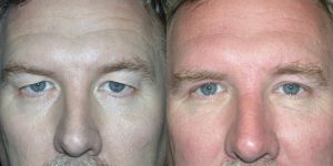 Before and After Image