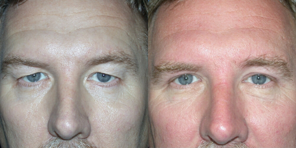 Before and After Image