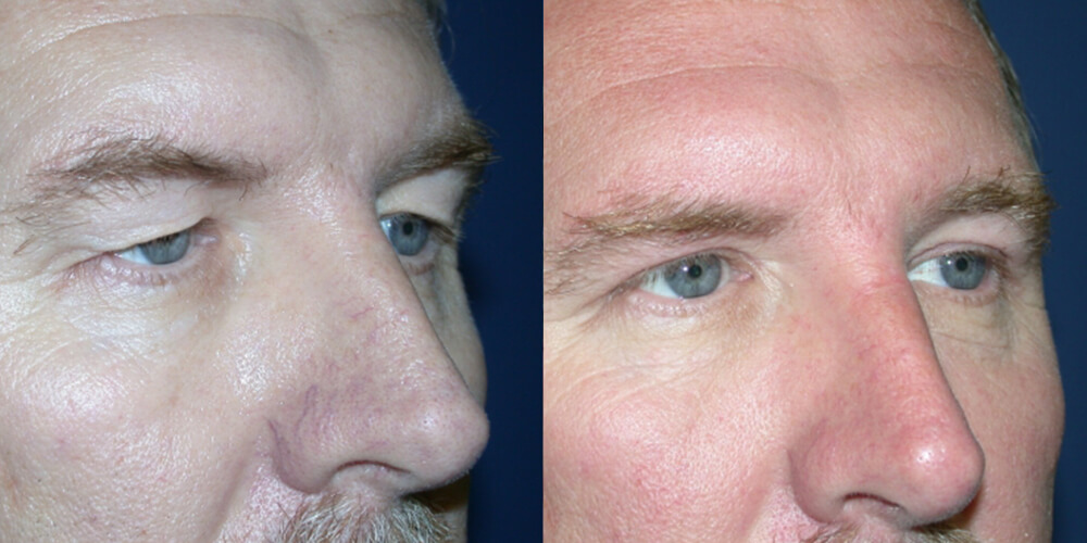 Before and After Image