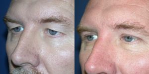 Before and After Image