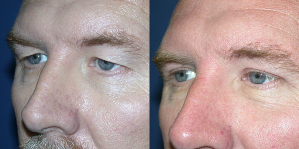 Before and After Image