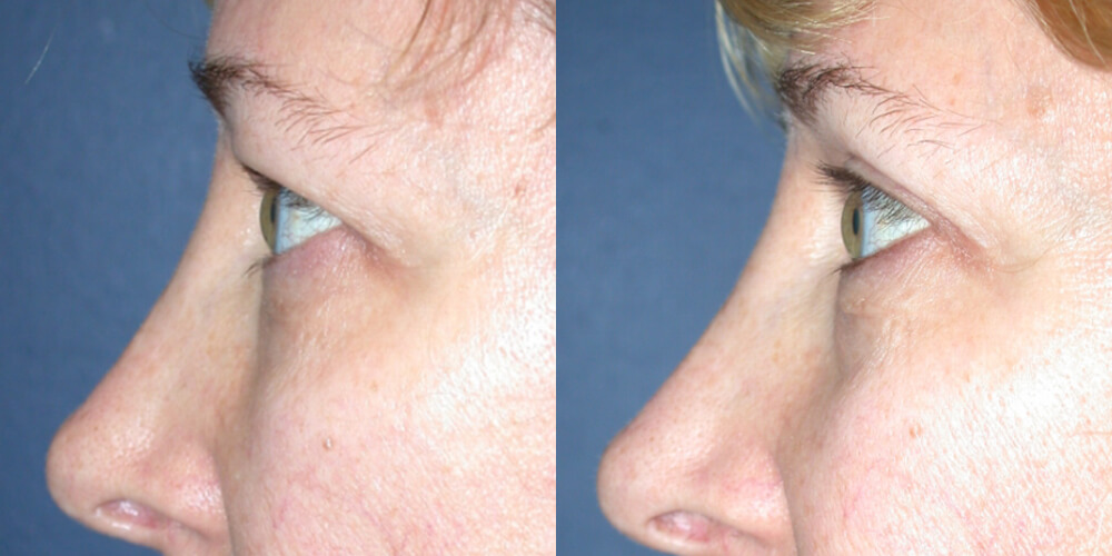 Before and After Image