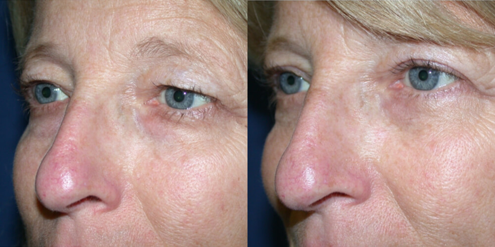 Before and After Image