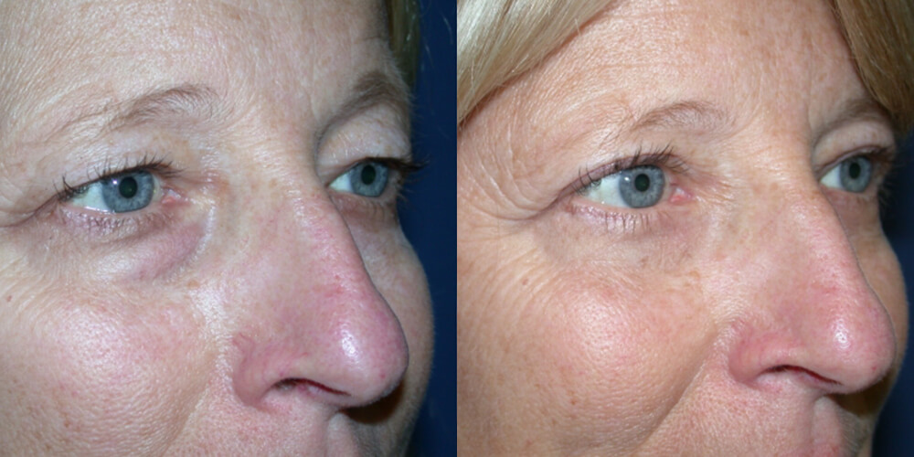 Before and After Image