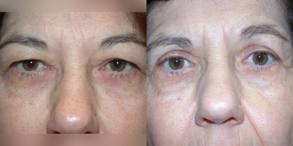 Before and After Image