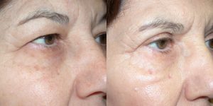 Before and After Image