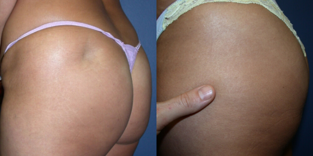 Before and After Image