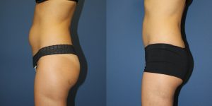 Before and After Image