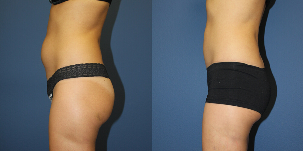 Before and After Image