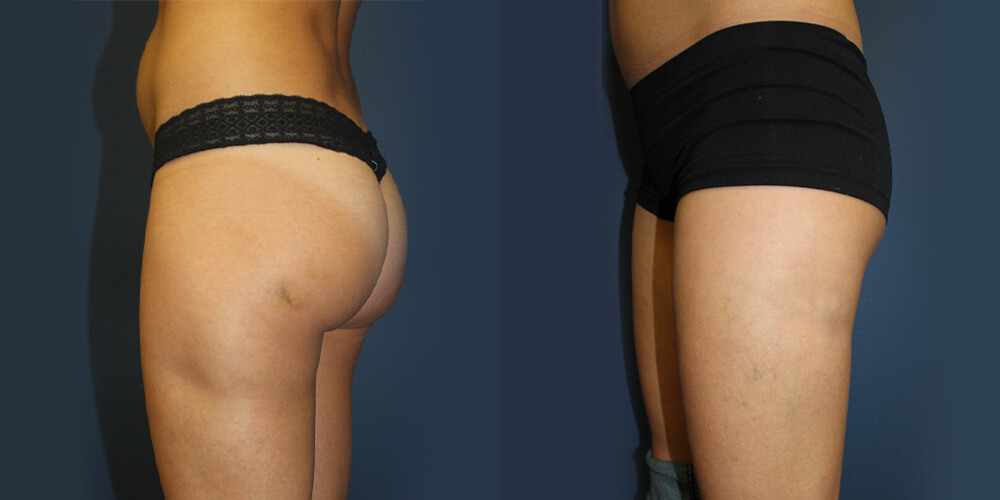 Before and After Image