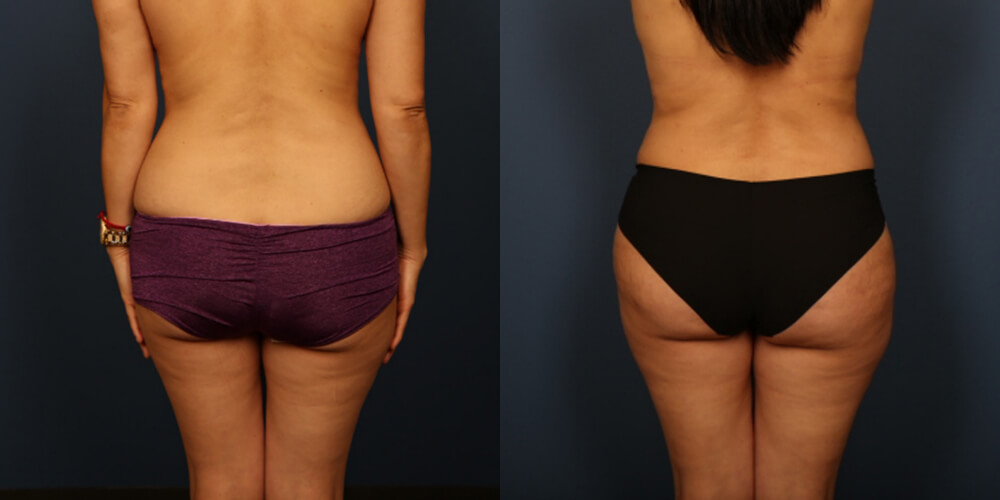 Before and After Image