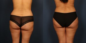 Before and After Image