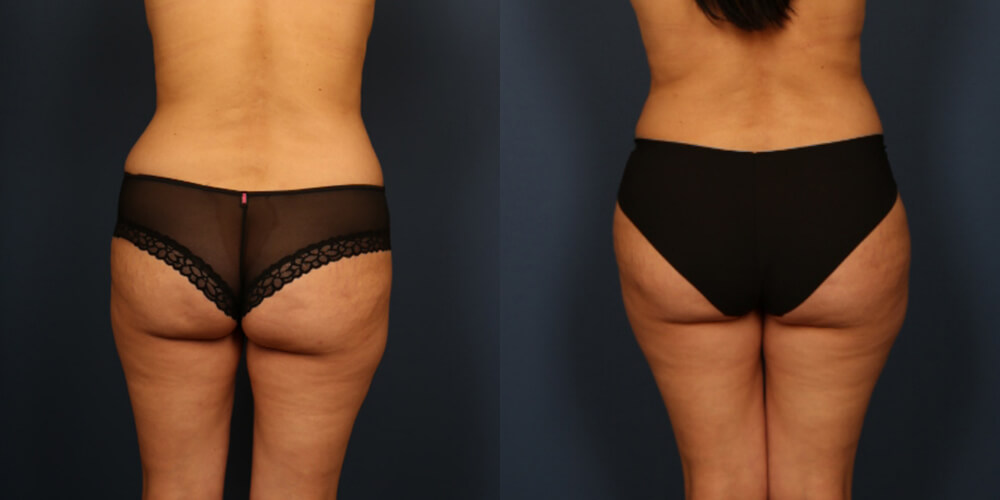 Before and After Image