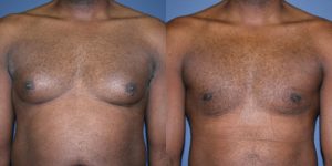 Before and After Image