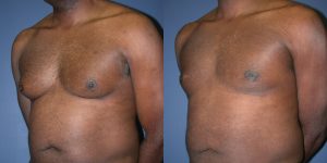 Before and After Image