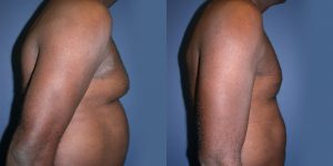 Before and After Image