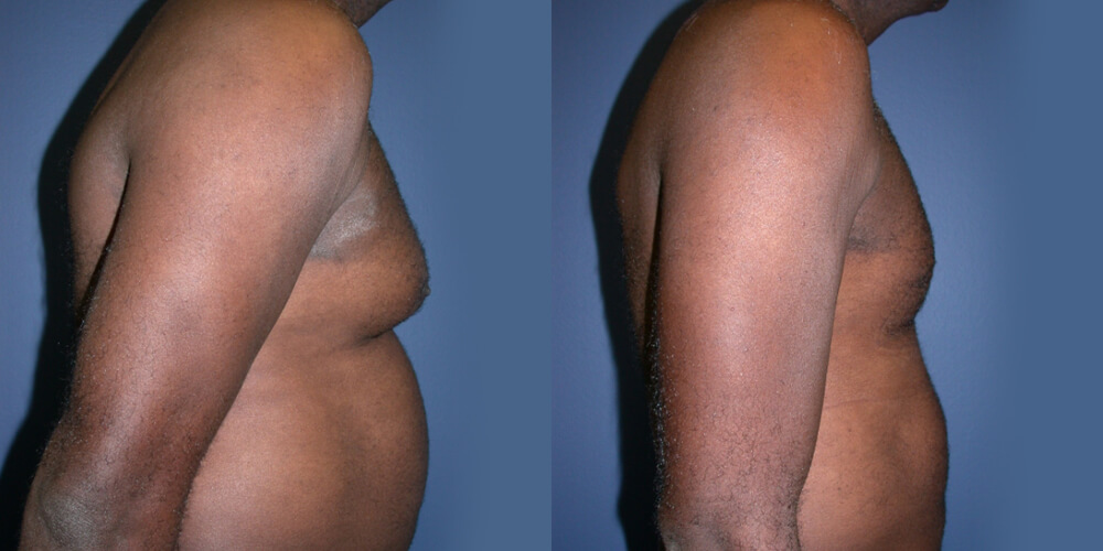 Before and After Image