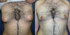 Before and After Image