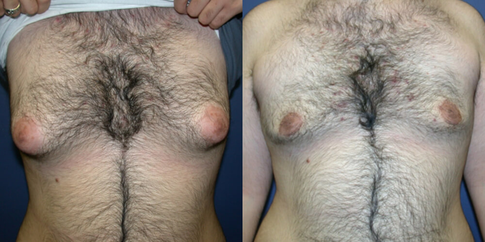 Before and After Image