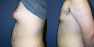 Before and After Image