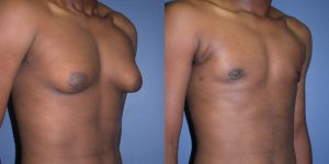 Before and After Image