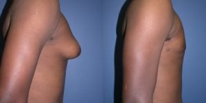 Before and After Image