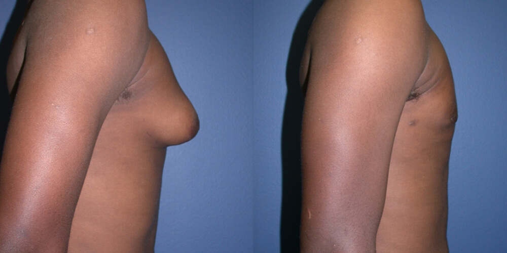 Before and After Image